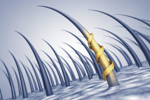 「発毛」「育毛」「増毛」「植毛」の意味と違い